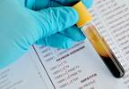 Sudden Cardiac Death Risk Linked to Higher Thyroid Levels Sudden Cardiac Death Risk Linked to Higher Thyroid Levels