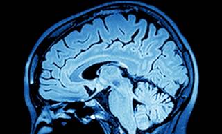 The initiative also made recommendations on the use of neuroimaging modalities. The initiative also made recommendations on the use of neuroimaging modalities.
