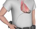 LVAD-Associated Mechanical Unloading in Ischemic and Nonischemic Cardiomyopathy LVAD-Associated Mechanical Unloading in Ischemic and Nonischemic Cardiomyopathy