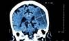 Cardiology Advisor's Best of 2016 Cardiology Advisor's Best of 2016