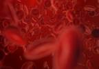 ESC and EACTS Provide New Dual Antiplatelet Therapy Guidelines in Coronary Heart Disease ESC and EACTS Provide New Dual Antiplatelet Therapy Guidelines in Coronary Heart Disease