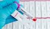 Revisiting the Clinical Utility of High Sensitivity Cardiac Troponin I Assays Revisiting the Clinical Utility of High Sensitivity Cardiac Troponin I Assays
