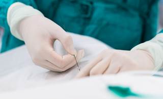 Endovascular therapy seems safe and efficacious for older adults with ischemic stroke. Endovascular therapy seems safe and efficacious for older adults with ischemic stroke.