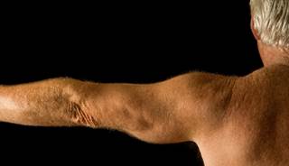 High arm and calf circumference were linked to better CVD outcomes. High arm and calf circumference were linked to better CVD outcomes.