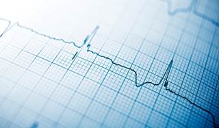 Electrocardiographs may be used as a means to lock and unlock a patient's electronic health records. Electrocardiographs may be used as a means to lock and unlock a patient's electronic health records.