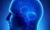 Noninvasive Brain Stimulation of Prefrontal Cortex in Trait Anxiety Noninvasive Brain Stimulation of Prefrontal Cortex in Trait Anxiety