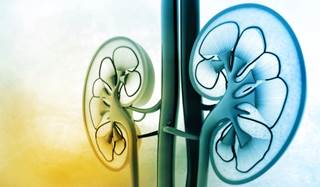 A prospective cohort study in 66 patients with ESRD was conducted to determine the link between renal and coronary heart diseases. A prospective cohort study in 66 patients with ESRD was conducted to determine the link between renal and coronary heart diseases.