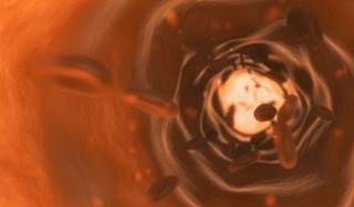 Gastrointestinal bleeding risk increased with age. Gastrointestinal bleeding risk increased with age.