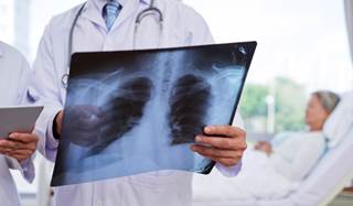 Statins categorized as higher potency may increase rather than lower the risk of hospitalization for community-acquired pneumonia. Statins categorized as higher potency may increase rather than lower the risk of hospitalization for community-acquired pneumonia.
