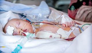 Researchers conducted a difference-in-differences analysis on birth and infant death data between 2007and 2013. Researchers conducted a difference-in-differences analysis on birth and infant death data between 2007and 2013.