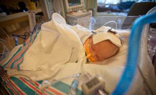 To reduce the incidence of SIRS in pediatric patients after heart surgery, researchers suggest restricting blood product use. To reduce the incidence of SIRS in pediatric patients after heart surgery, researchers suggest restricting blood product use.