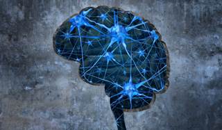 Researchers examined the effect of MI on cardiac and brain inflammation in 49 mice. Researchers examined the effect of MI on cardiac and brain inflammation in 49 mice.
