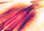 PCI: Prevalence and Effect of Silent Diabetes PCI: Prevalence and Effect of Silent Diabetes