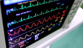 Examination of over 1 million Medicare records found that the intensive care unit was overused for patients with heart and lung conditions. Examination of over 1 million Medicare records found that the intensive care unit was overused for patients with heart and lung conditions.