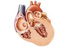 Cardiometabolic and Mortality Risks in Chronic Inflammatory Disorders Cardiometabolic and Mortality Risks in Chronic Inflammatory Disorders