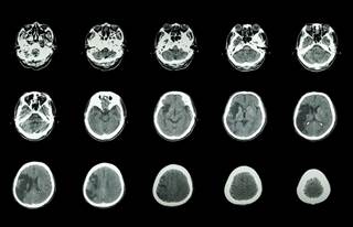 The odds of being discharged home after stroke were increased more than 12-fold in patients who had above-average outcome scores. The odds of being discharged home after stroke were increased more than 12-fold in patients who had above-average outcome scores.