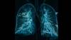 Long-Term Oxygen Therapy Beneficial in COPD with Moderate Desaturation? Long-Term Oxygen Therapy Beneficial in COPD with Moderate Desaturation?