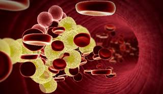 Each decrease of 39 mg/dL on-treatment LDL-C was associated with a 22% lower risk of MACE in men and 29% lower risk in women. Each decrease of 39 mg/dL on-treatment LDL-C was associated with a 22% lower risk of MACE in men and 29% lower risk in women.