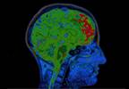 Should CHA2DS2-VASc Be Reassessed More Frequently to Improve Stroke Prevention in Afib? Should CHA2DS2-VASc Be Reassessed More Frequently to Improve Stroke Prevention in Afib?