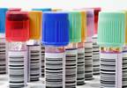 Low Tryptophan May Signal Diabetic Nephropathy Low Tryptophan May Signal Diabetic Nephropathy