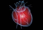 Levodopa May Benefit Heart Health in Parkinson's Disease Levodopa May Benefit Heart Health in Parkinson's Disease