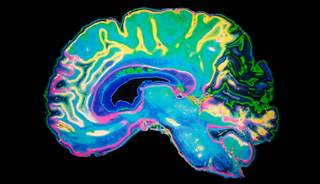 Researchers found that ventricular volumes increased more in the oral conjugated equine estrogen group than the placebo group. Researchers found that ventricular volumes increased more in the oral conjugated equine estrogen group than the placebo group.