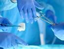 ARDS Risk After Cardiac Surgery During Flu Season ARDS Risk After Cardiac Surgery During Flu Season