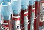 HIV occurrences decline in Uganda from 1999 to 2016 HIV occurrences decline in Uganda from 1999 to 2016