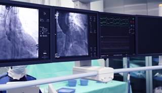 imilarly, the risk of renal-replacement therapy was 0.71. imilarly, the risk of renal-replacement therapy was 0.71.