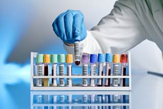 Risk scores summarizing 8 diseases, markers tied to cancer risk in dose-response manner Risk scores summarizing 8 diseases, markers tied to cancer risk in dose-response manner