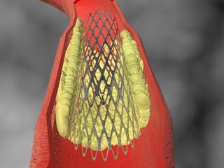 The researchers found that sildenafil reduced the clumping of blood platelets by 30%. The researchers found that sildenafil reduced the clumping of blood platelets by 30%.