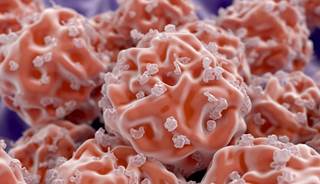 Researchers found that patients treated with UC-MSCs experienced improvement in left ventricular function, functional status, and quality of life. Researchers found that patients treated with UC-MSCs experienced improvement in left ventricular function, functional status, and quality of life.