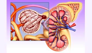 Hyperuricemia is common in patients with CKD Hyperuricemia is common in patients with CKD