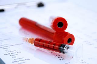 Uric acid, fasting plasma glucose, and hemoglobin A1C showed smaller mediation effects on the risk for CV death with empagliflozin. Uric acid, fasting plasma glucose, and hemoglobin A1C showed smaller mediation effects on the risk for CV death with empagliflozin.