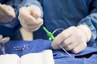 Investigation triggered by meta-analysis showing possible increased mortality in PAD patients at 2 years Investigation triggered by meta-analysis showing possible increased mortality in PAD patients at 2 years