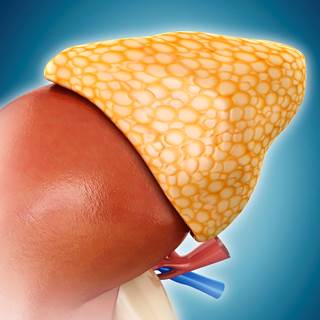 Between 10% and 20% of patients with hypertension have primary aldosteronism. Between 10% and 20% of patients with hypertension have primary aldosteronism.