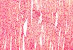 Ferumoxytol-enhanced MRI Detects Cellular Inflammation Post Myocardial Infarction Ferumoxytol-enhanced MRI Detects Cellular Inflammation Post Myocardial Infarction
