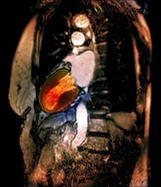 Stress can be a precipitating factor for cardiovascular-related problems. Stress can be a precipitating factor for cardiovascular-related problems.