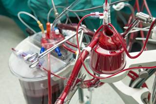 After a year, more patients who had an off-pump operation died or needed new procedures. After a year, more patients who had an off-pump operation died or needed new procedures.