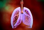 Pulmonary Complications After Noncardiac Surgery Ameliorated By Pulmonary Rehab Pulmonary Complications After Noncardiac Surgery Ameliorated By Pulmonary Rehab
