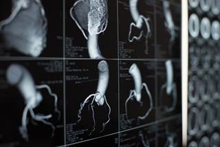 Clinical opinions may vary for a specific scenario; even appropriate tests may not always be necessary depending on physician judgment. Clinical opinions may vary for a specific scenario; even appropriate tests may not always be necessary depending on physician judgment.