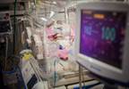 Bronchopulmonary Dysplasia and Pulmonary Hypertension in Preterm Neonates Bronchopulmonary Dysplasia and Pulmonary Hypertension in Preterm Neonates