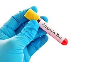 Higher mortality was seen in participants with low serum albumin and a high STS. Higher mortality was seen in participants with low serum albumin and a high STS.