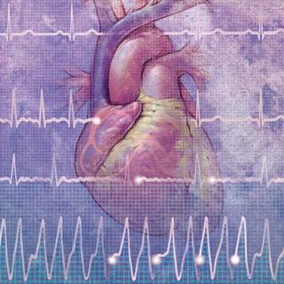 There may be a relationship between traumatic life event stress and afib in women over the age of 45 years old. There may be a relationship between traumatic life event stress and afib in women over the age of 45 years old.
