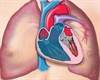 Key Hemodynamic Differences Noted With Scleroderma-Associated PAH vs Idiopathic PAH Key Hemodynamic Differences Noted With Scleroderma-Associated PAH vs Idiopathic PAH
