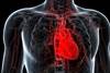 SGLT2 Inhibitor Use Linked to Lower Risk for Heart Failure, Death in Type 2 Diabetes SGLT2 Inhibitor Use Linked to Lower Risk for Heart Failure, Death in Type 2 Diabetes