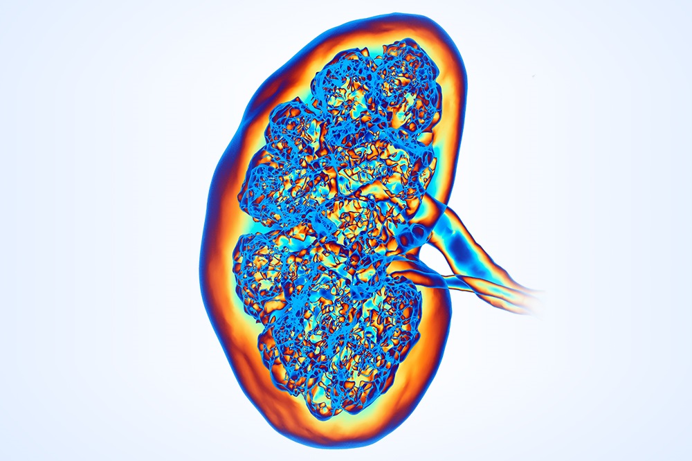 pulmonary-arterial-hypertension-survival-may-be-linked-to-kidney-function