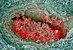 Antithrombotic Therapy for Atrial Fibrillation and Valvular Heart Disease: New Joint Consensus Statement Antithrombotic Therapy for Atrial Fibrillation and Valvular Heart Disease: New Joint Consensus Statement