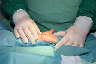 A total of 304 CTR procedures were performed on 246 patients during the study period. A total of 304 CTR procedures were performed on 246 patients during the study period.