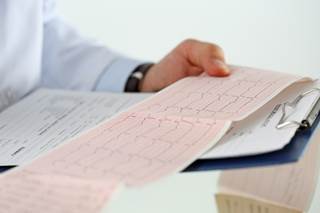 Hydroquinidine lowered the annual rate of life-threatening arrhythmic events in patients with previous cardiac arrest. Hydroquinidine lowered the annual rate of life-threatening arrhythmic events in patients with previous cardiac arrest.